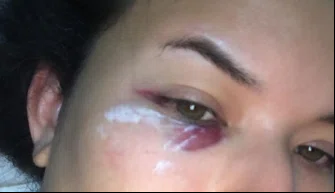 Jornalista denuncia agressão